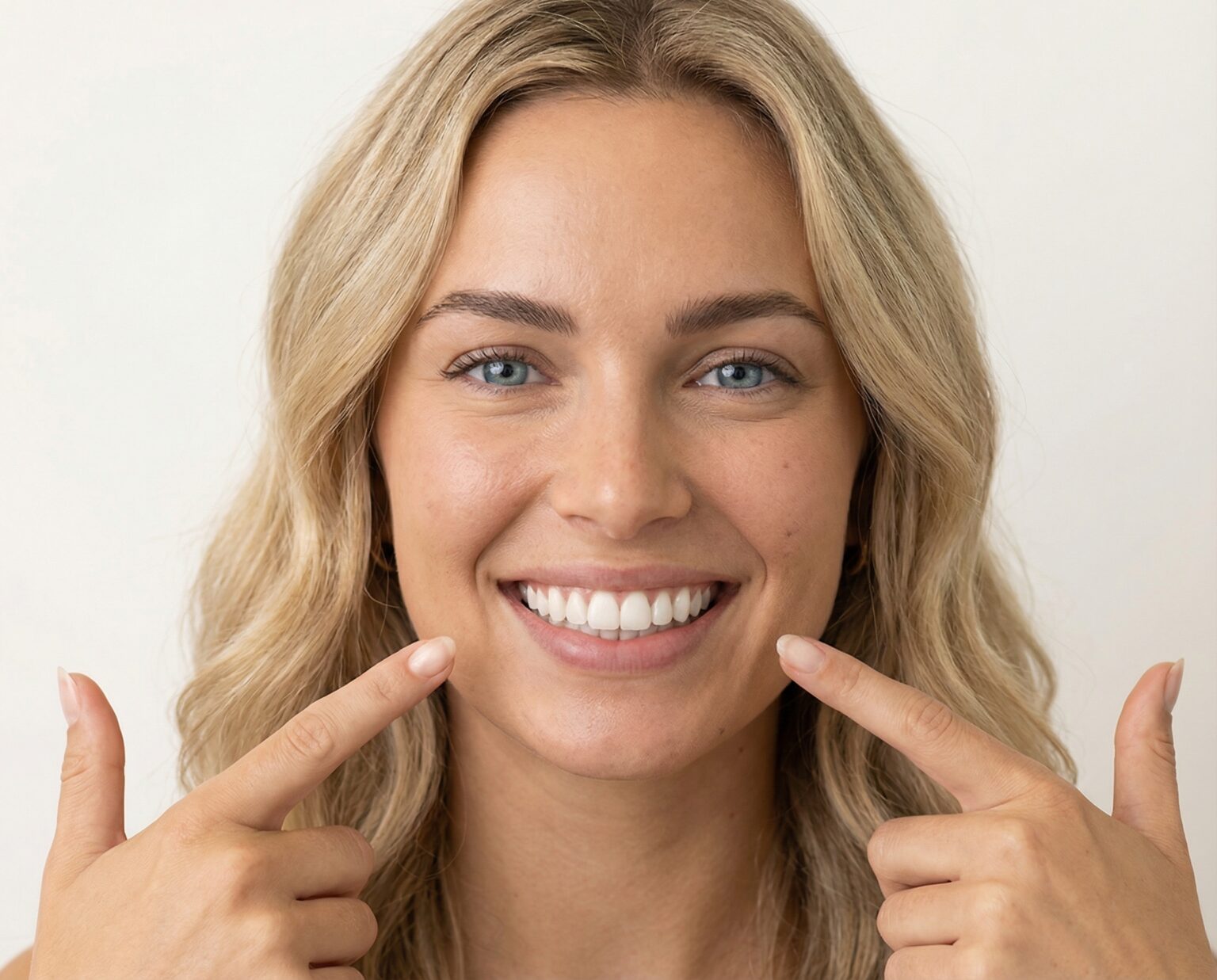 Smile design before after